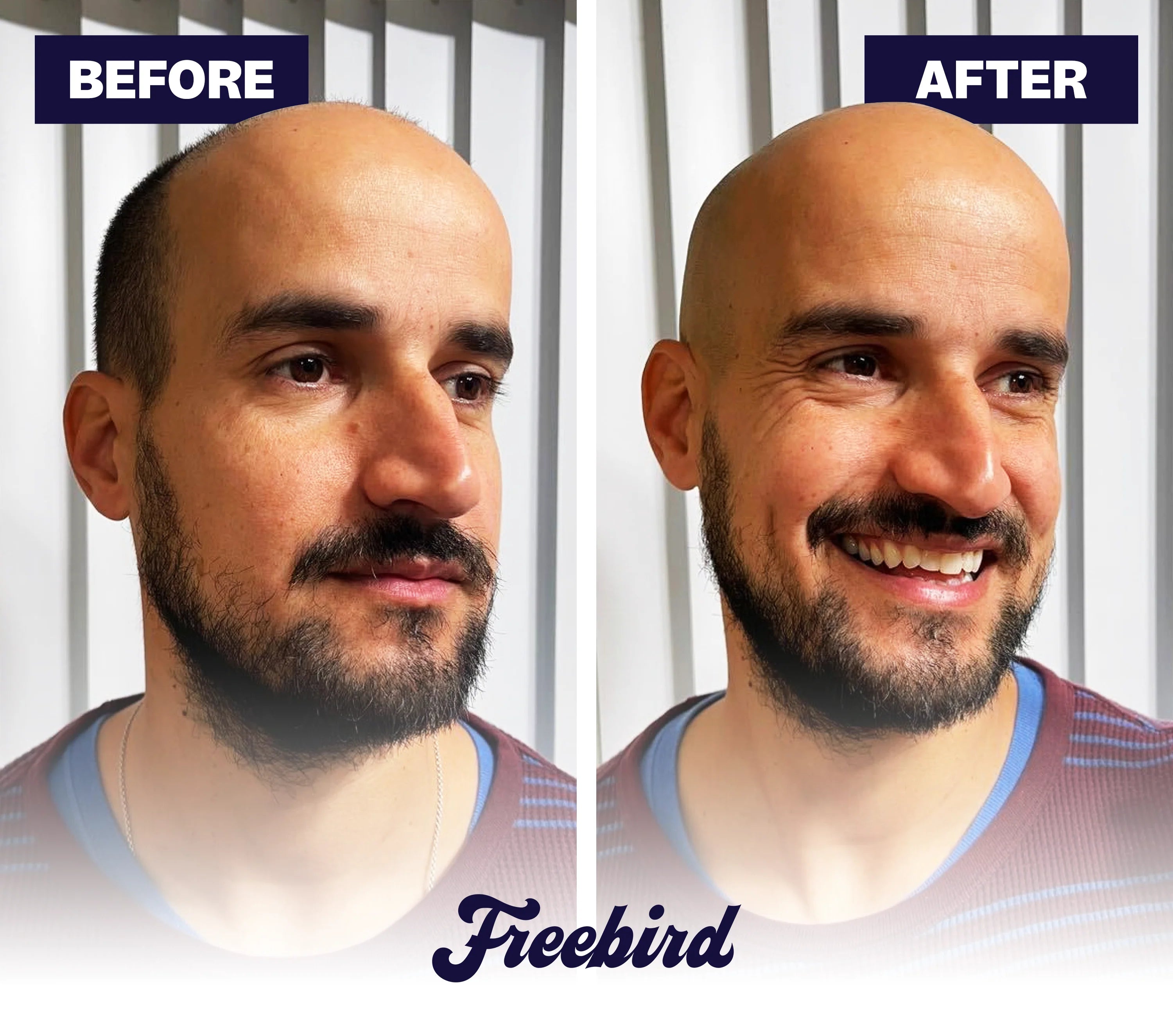 FlexSeries® Shaving Kit - View 3