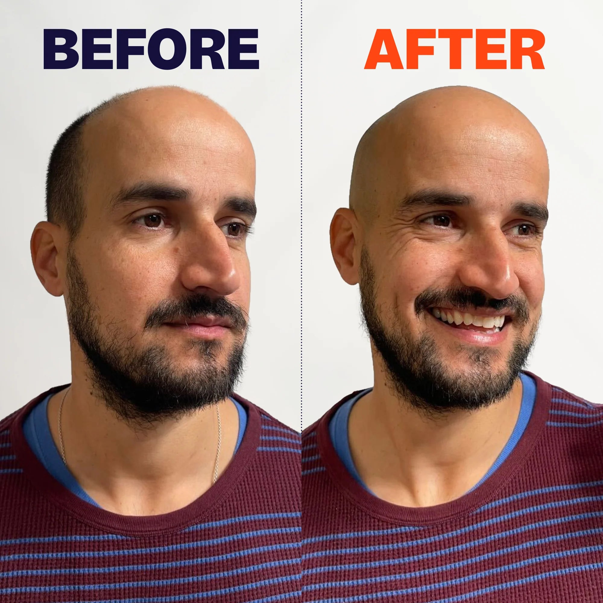 FlexSeries® Pro Shaving Kit - View 4